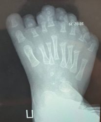 post-22583 thumbnail