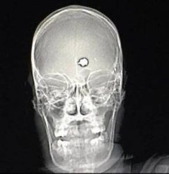 post-27873 thumbnail