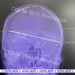 post-28889 thumbnail